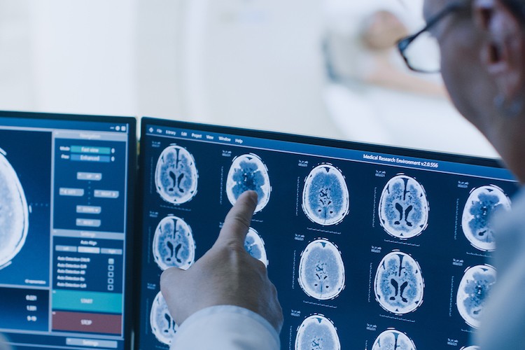 Neurology Scans Neurology Scans